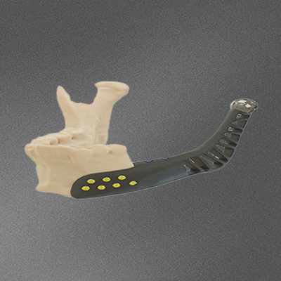 Medical Workpiece Example 1